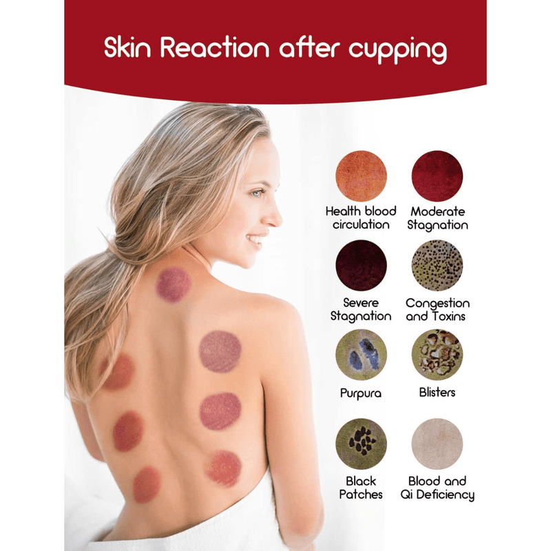 Electric Vacuum Cupping Professional Hijama Machine